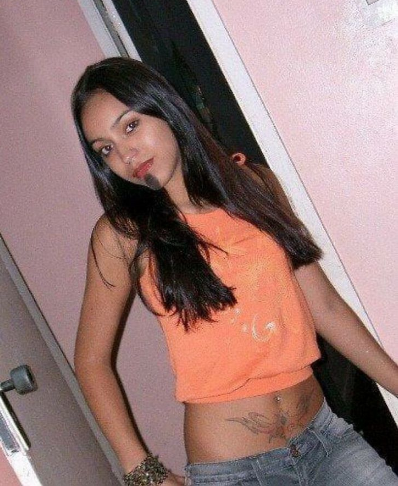 Captura de Tela 376 - Jovem com vitiligo usou a modelagem para superar a baixa autoestima. Agora admire sua beleza