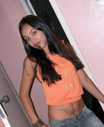 sensivel-mente.com - Jovem com vitiligo usou a modelagem para superar a baixa autoestima. Agora admire sua beleza