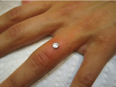 sensivel-mente.com - "Bridal Piercing": A tend&ecirc;ncia para substituir as alian&ccedil;as de casamento. Os m&eacute;dicos n&atilde;o recomendam