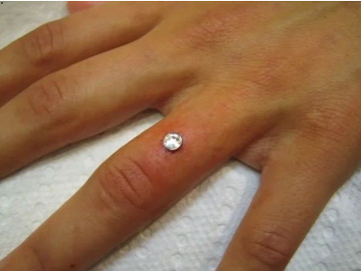 sensivel-mente.com - "Bridal Piercing": A tendência para substituir as alianças de casamento. Os médicos não recomendam