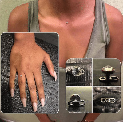 sensivel-mente.com - "Bridal Piercing": A tend&ecirc;ncia para substituir as alian&ccedil;as de casamento. Os m&eacute;dicos n&atilde;o recomendam
