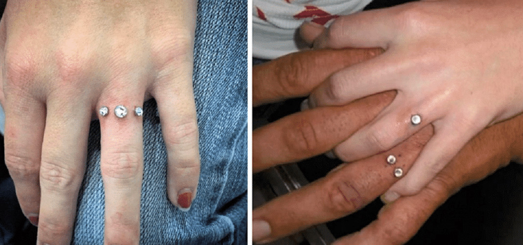 “Bridal Piercing”: A tendência para substituir as alianças de casamento. Os médicos não recomendam