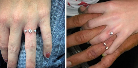 “Bridal Piercing”: A tendência para substituir as alianças de casamento. Os médicos não recomendam