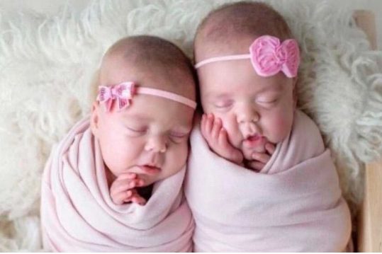 sensivel-mente.com - Os médicos estimaram que as gêmeas não sobreviveriam e agora estão com 3 anos