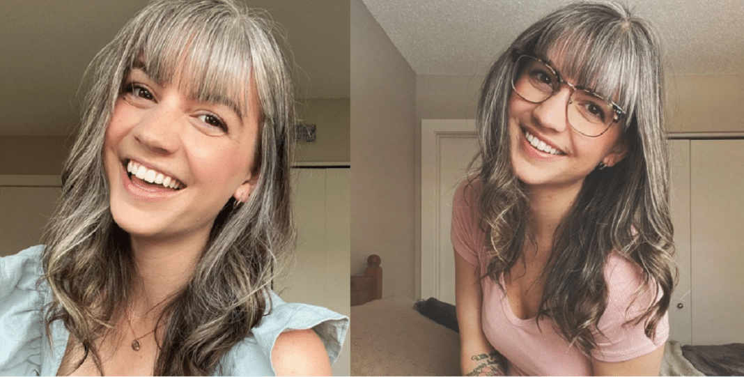 Mulher de 26 anos inspira ao assumir seus cabelos grisalhos que ela tinha desde a infância
