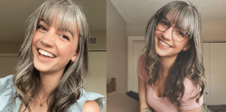 Mulher de 26 anos inspira ao assumir seus cabelos grisalhos que ela tinha desde a infância