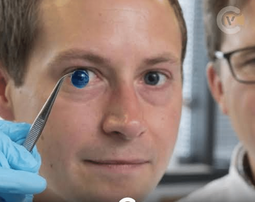 Israel faz história: médicos implantam pela primeira vez córnea biofabricada em humano