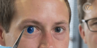 Israel faz história: médicos implantam pela primeira vez córnea biofabricada em humano Israel faz história: médicos implantam pela primeira vez córnea biofabricada em humano