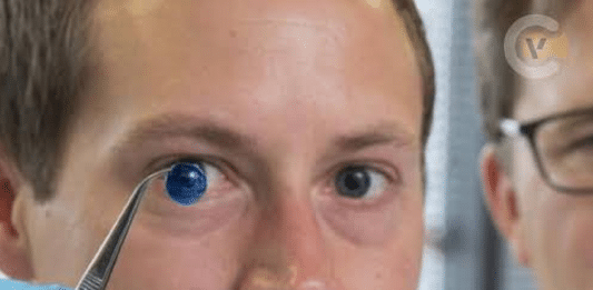 Israel faz história: médicos implantam pela primeira vez córnea biofabricada em humano