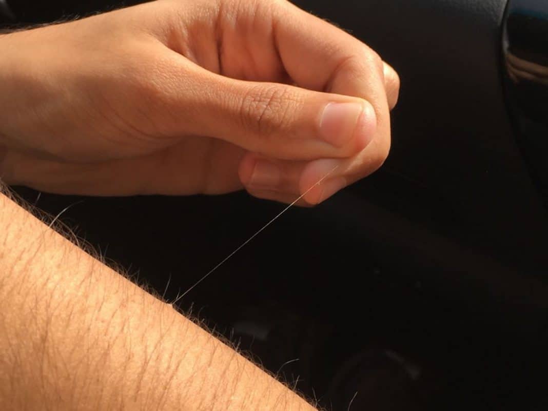 Por que surge um pelo longo “do nada” no corpo? a explicação está surpreendendo muita gente